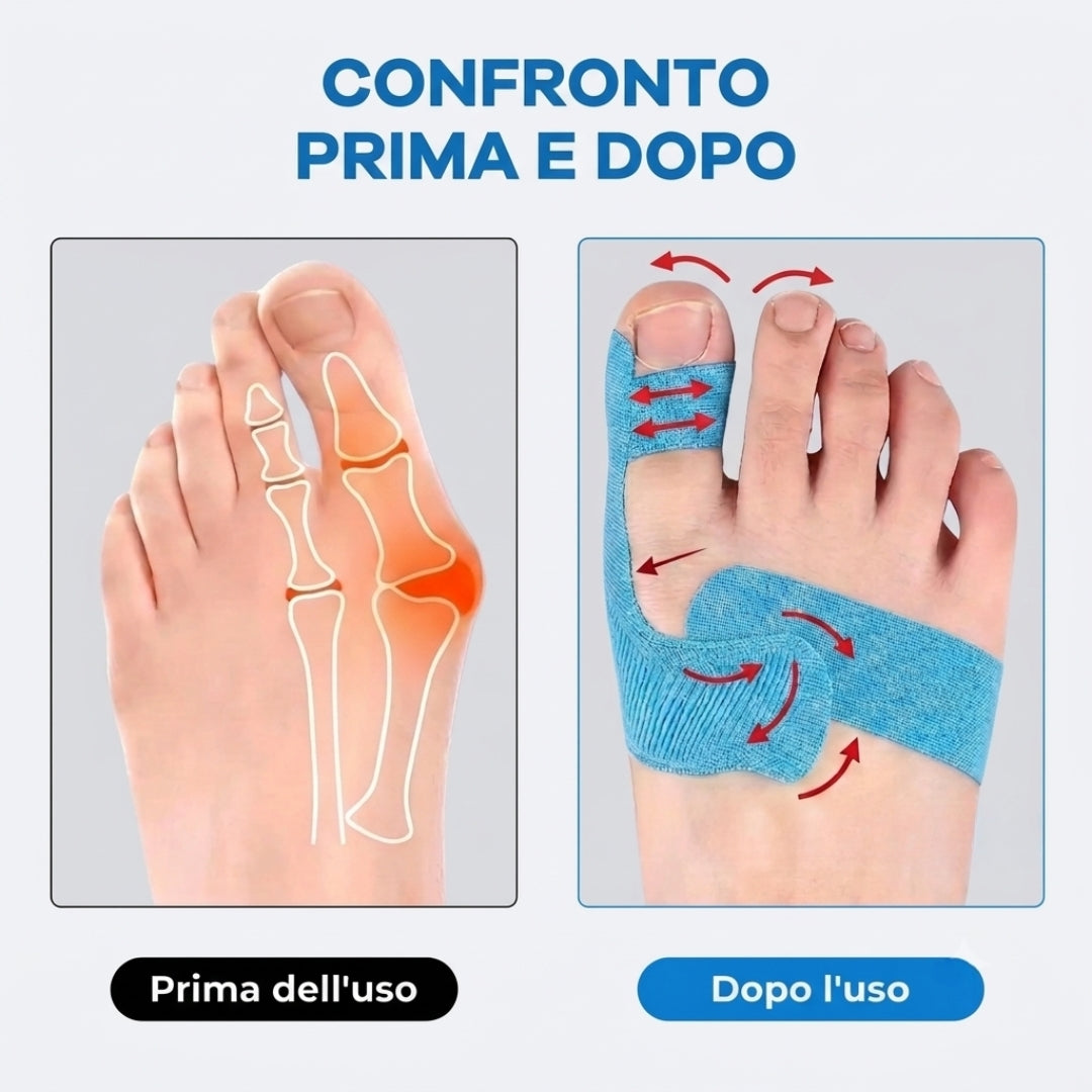 OrthoFlex™ - Nastro Per Alluce Valgo